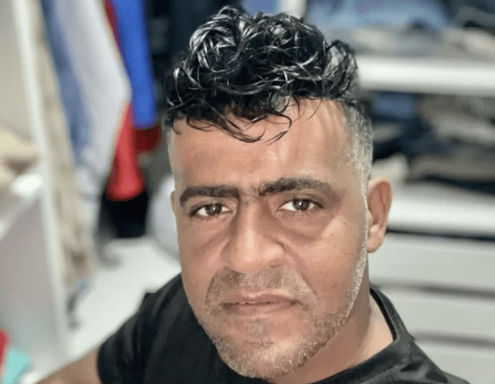 Homem morre após passar mal em clínica de implante capilar na Bahia