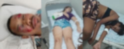 Ibirataia: Acidente deixa três pessoas feridas e gera clamor por justiça