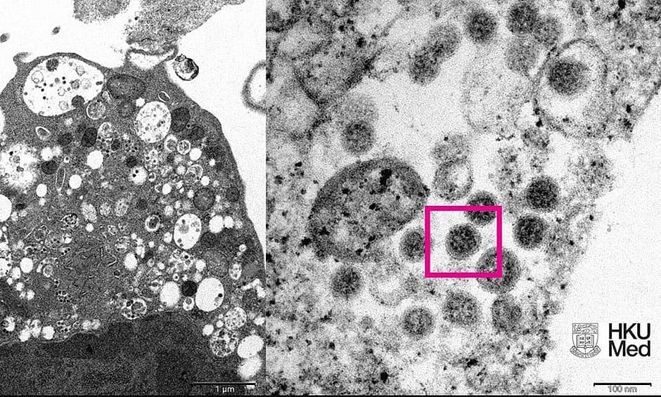 Ômicron é variante que sobrevive por mais tempo na pele e em superfícies plásticas, aponta estudo