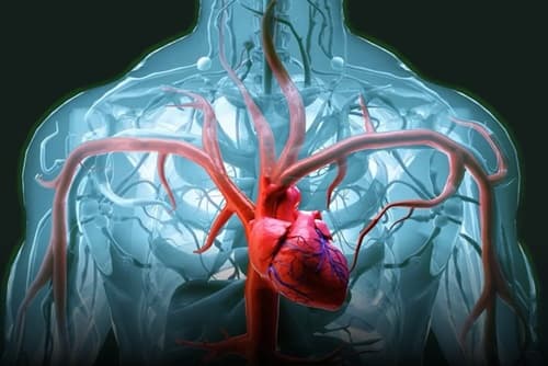 Nova definição global propõe mudanças na classificação do infarto