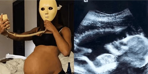 Anitta intriga fãs com fotos de gravidez relacionadas: novo clipe ou colaboração com The Weeknd?
