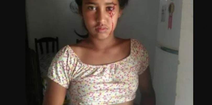 Menina do Piauí chora sangue e busca diagnóstico para realizar tratamento