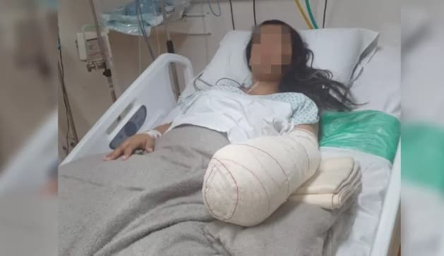 Jovem de 24 anos entra em hospital para dar à luz e sai com mão e punho amputados