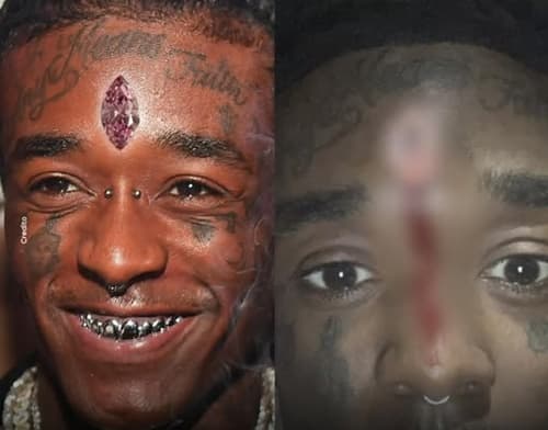 Lil Uzi Vert perde diamante de 24 milhões de dólares implantado na testa durante show