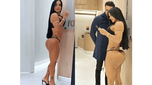Kamila Simioni faz cirurgia para reparar bumbum deformado por hidrogel