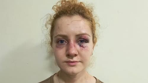 Mãe de jovem agredida na BR-430 cobra justiça pela liberdade dos suspeitos