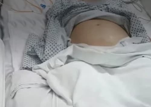 Bebê de Jovem que teve morte cerebral nasce prematuro