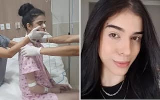 Internada após cheirar pimenta consegue se sentar durante fisioterapia