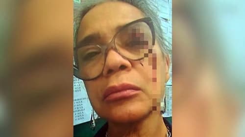 Professora é agredida com socos após cobrar atividade de aluno em escola
