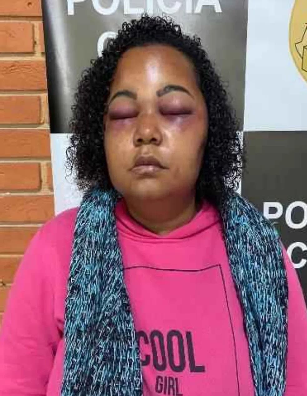 ‘Só sobrevivi porque fingi estar morta’, diz professora que foi espancada pelo marido em Jacareí