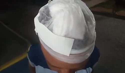 Homem é alvo de facãozadas cujo motivo é desconhecido