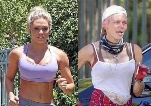 Loni Willison: Da Fama ao Abandono nas Ruas de Los Angeles