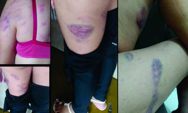 Mulher leva surra de corda da ex-sogra em Capim Grosso