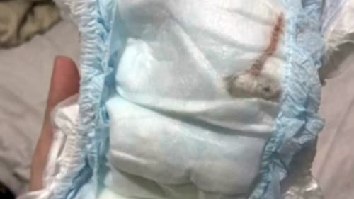 Rato morto em fralda de recém-nascido causa revolta e alerta sobre qualidade dos produtos infantis