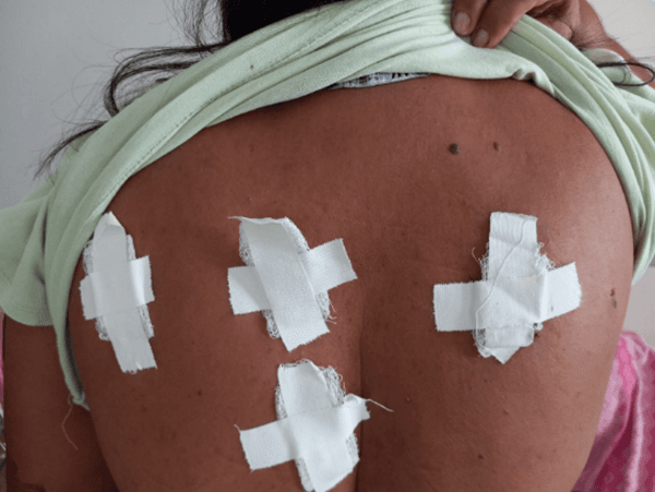 Ex-moradora de Medeiros Neto fica ferida após levar facadas do marido em Teixeira