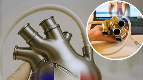 Austrália registra primeiro paciente a viver 100 dias com coração artificial de titânio