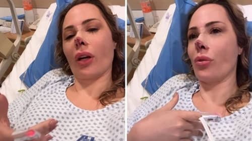 Influenciadora Ju Isen é atacada por cão e passa por cirurgia de reconstrução do nariz