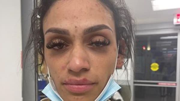 Esposa mostra lesões no corpo após alegar agressão de jogador da NBA