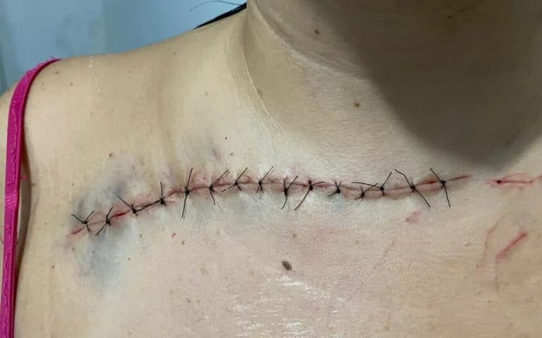Mulher é golpeada com estilete pelo filho em Salvador