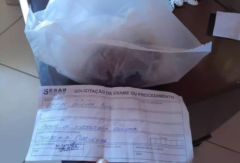 Jovem perde rim e hospital entrega órgão a família em saco plástico