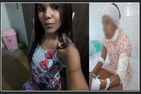 Brigando por ciúmes garota joga gasolina e toca fogo na outra na Ba