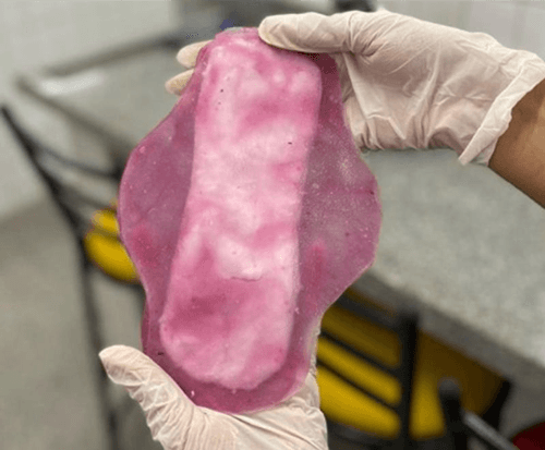 Estudantes do Cetep criam absorventes que aliviam dores menstruais