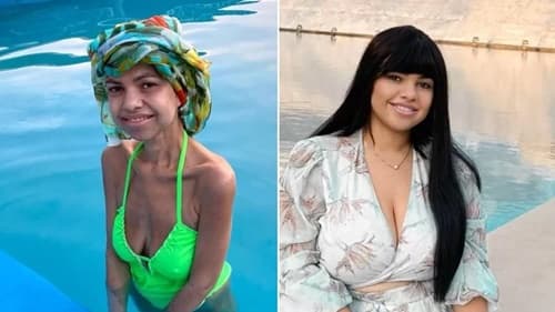 Fotógrafa perde 83 kg após bariátrica, sofre complicações e precisa reverter cirurgia
