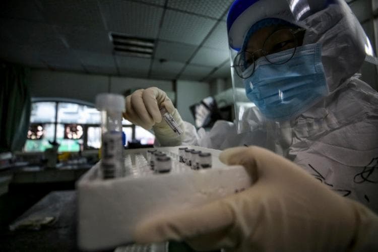 Bahia registra um óbito pela covid-19 neste domingo registrado e validado.