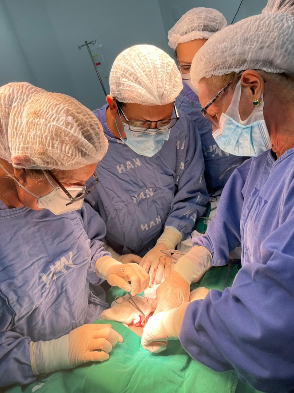 Pela primeira vez, equipe 100% baiana realiza cirurgia para separação de gêmeos siameses