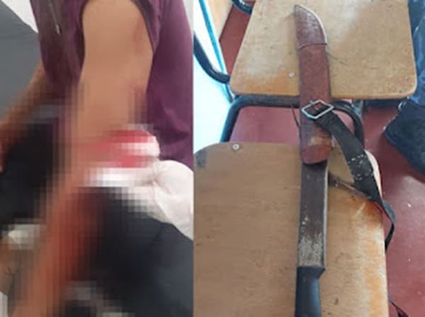 Homem é preso após tentar matar o próprio filho com golpes de facão na Bahia
