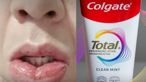 Anvisa recebe mais de 1,2 mil queixas sobre nova fórmula da pasta Colgate Clean Mint