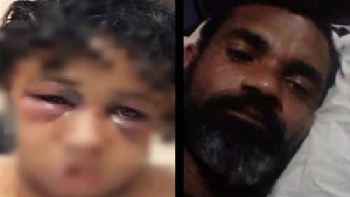 Homem que espancou e queimou rosto de companheira com maçarico é preso em Salvador