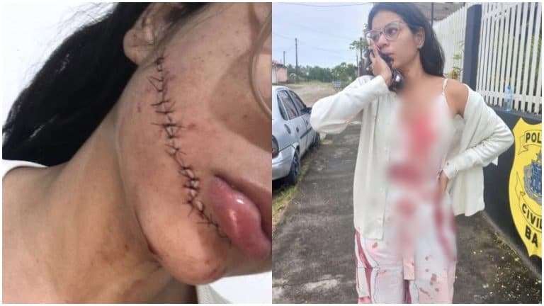 Garota de 23 anos leva facada no rosto enquanto dormia dentro de ônibus