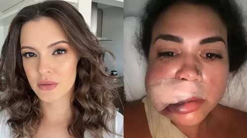 Justiça toma decisão após modelo desfigurar rosto de mulher em restaurante de luxo