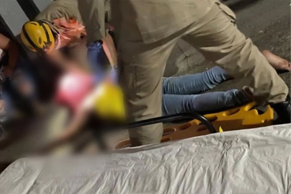 Jovem ateia fogo em colega dentro de escola após críticas a bronzeamento