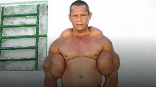 Morte de Arlindo Anomalia repercute na imprensa internacional