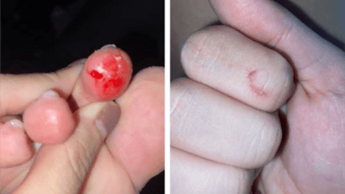Caso de piranhas em Jequié assusta banhistas