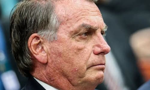 STF autoriza Bolsonaro a deixar prisão domiciliar para cirurgia no DF