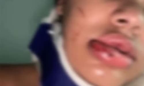 Jovem pula de moto em movimento para fugir de agressões em Ilhéus