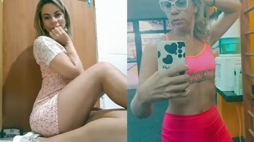 Comerciante morre após harmonização estética