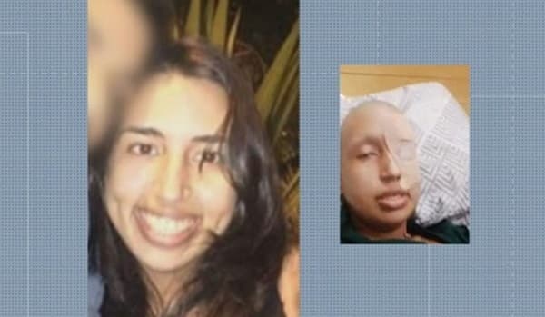 Polícia investiga se mulher forjou câncer e até raspou a cabeça por doações que somam R$ 50 mil