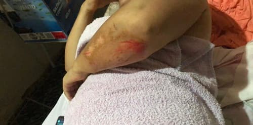 Mulher sofre dois acidentes na mesma noite por causa de animais nas estradas