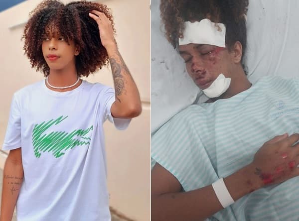 Influenciador Baiano sofre violência Extrema: Rosto deformado e unhas arrancadas após resistência a assalto