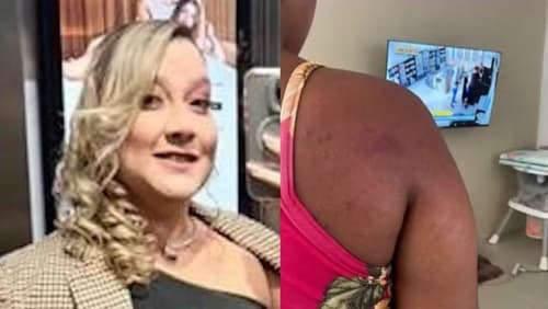 Doméstica grávida é torturada após acusação de roubo e caso choca o país