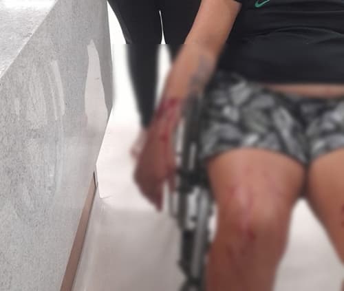 Ipiaú: Mulher fica ferida após ser atacada por cachorro em praça pública