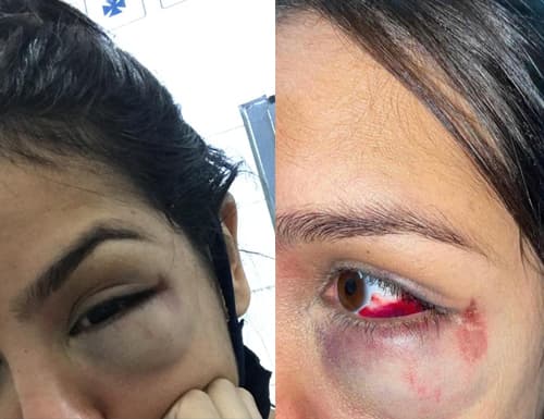 Porto Seguro: Jovem denuncia policial após sofrer agressão durante evento