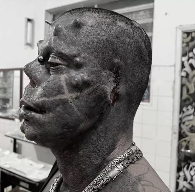 Homem celebra fim da obrigatoriedade das máscaras arrancando a própria orelha