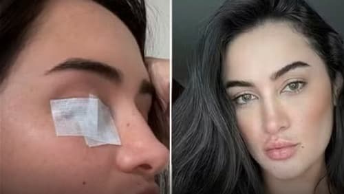 Gabi Melim é diagnosticada com paralisia de Bell e tranquiliza fãs nas redes sociais